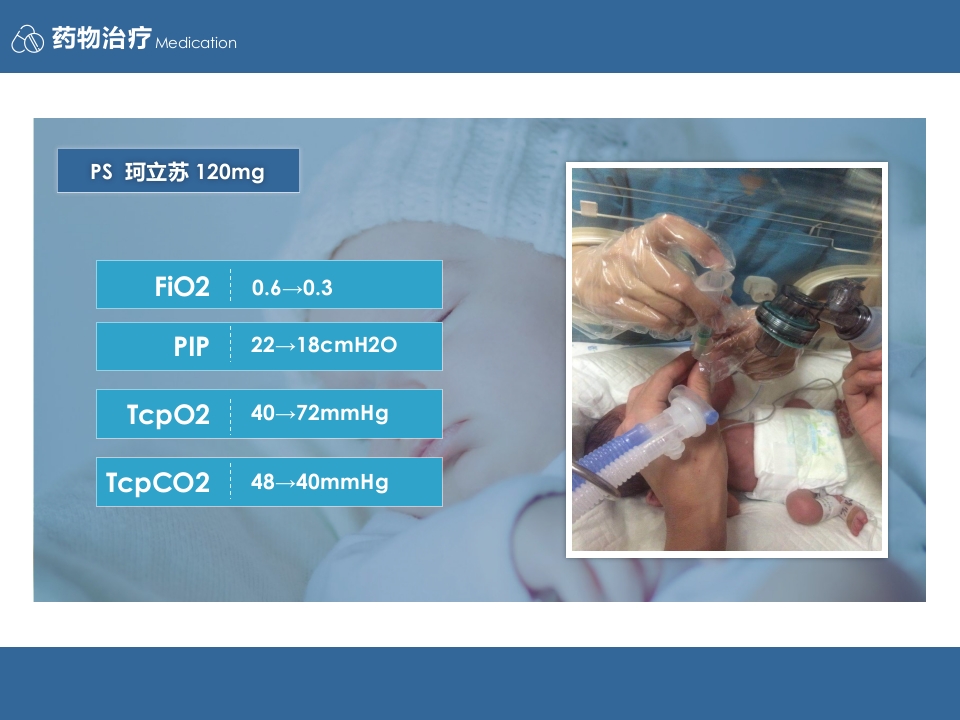 1例VLBW患儿临床病例分享PPT案例模板5