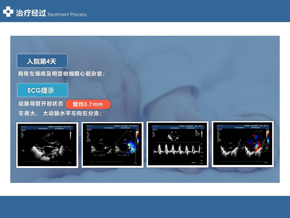 1例VLBW患儿临床病例分享PPT案例模板8