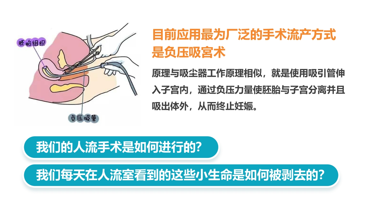 幸福生活从科学避孕开始PPT5